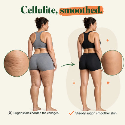 Cellulite smoothed — before and after